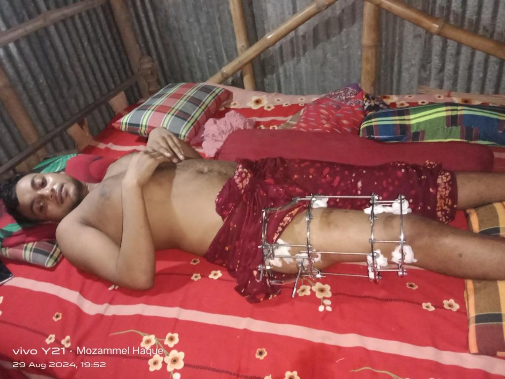 বৈষম্যবিরোধী আন্দোলনে গুলিতে আহত দামুড়হুদার মোফাইল