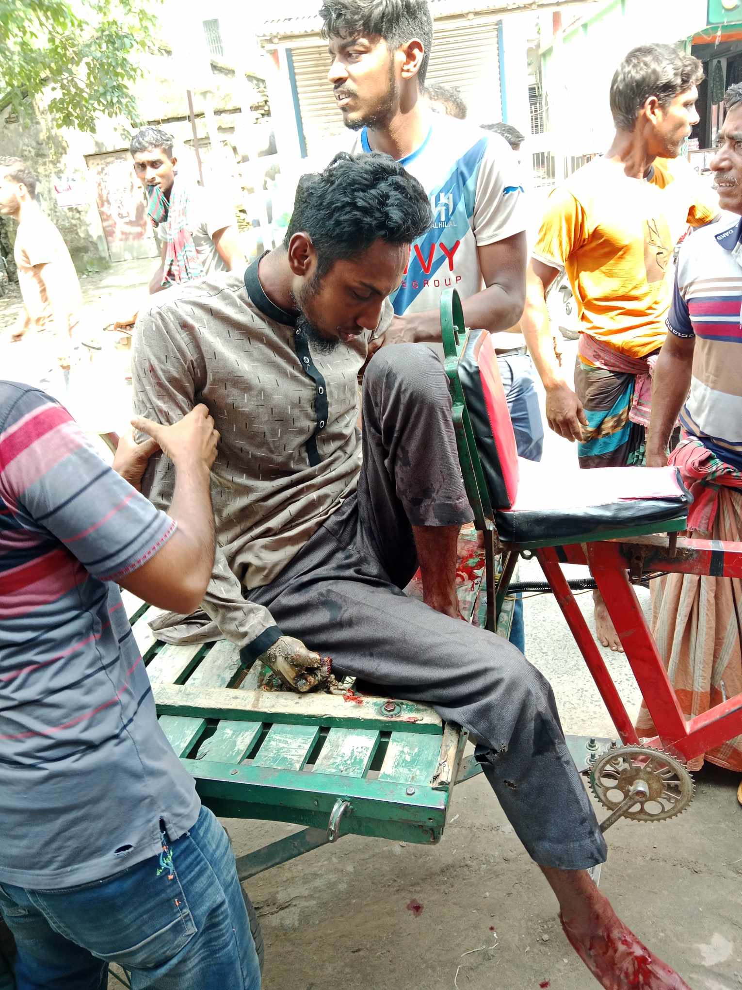 আন্দুলবাড়ীয়ায় বৈদ্যুতিক শর্ট সার্কিটে দুজন দগ্ধ