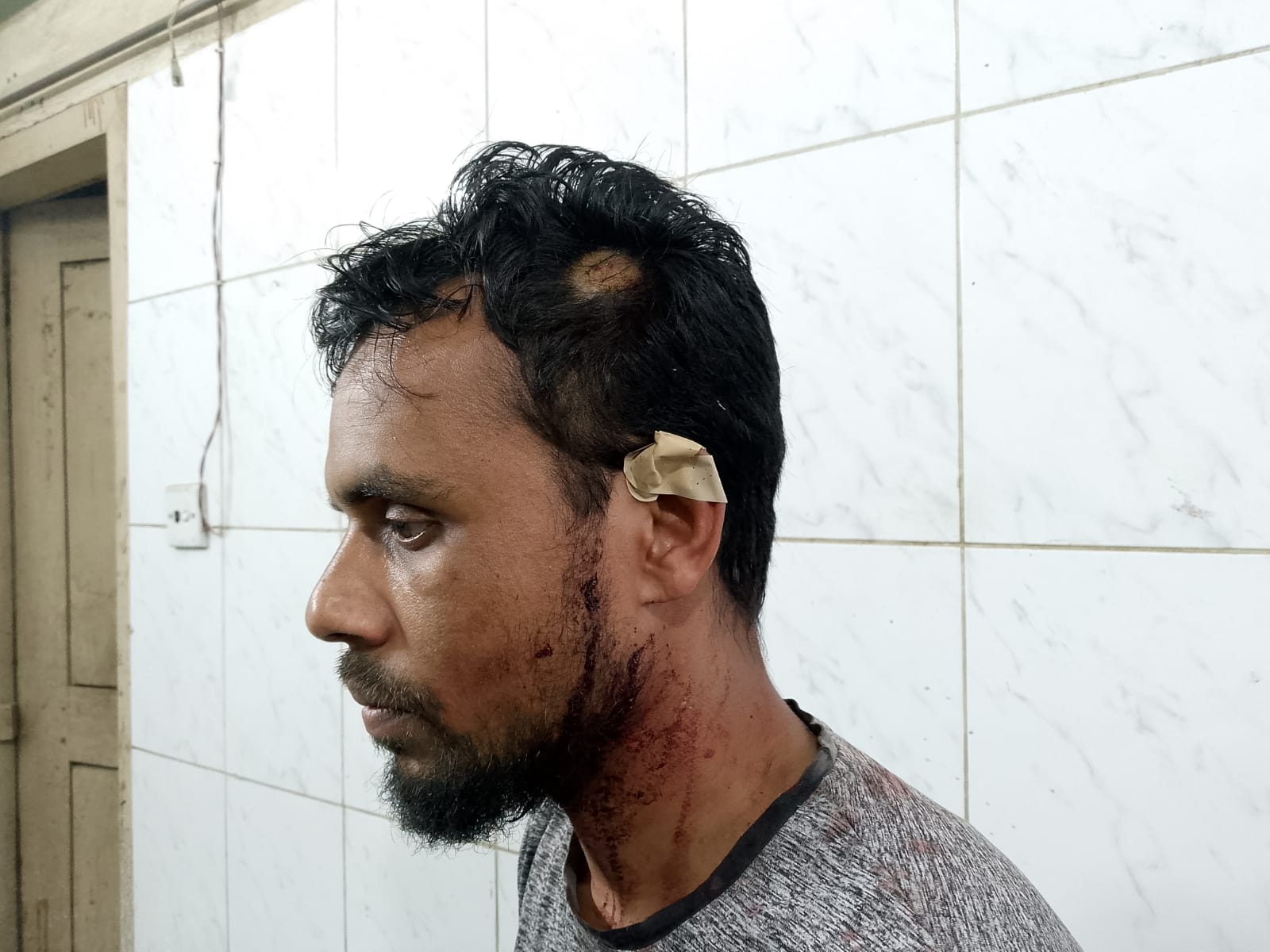 গাংনীতে মাদক সেবনে নিষেধ করায় সাংবাদিকের ওপর হামলা