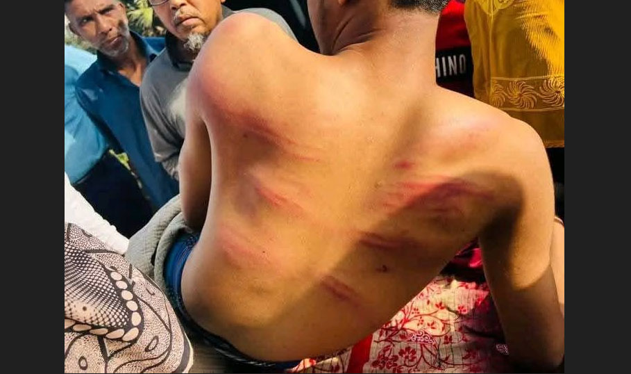 মাদ্রাসা ছাত্রকে হাত-পা বেঁধে পেটালেন শিক্ষক