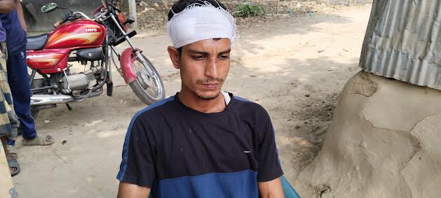 দর্শনায় গরুকে ভুট্টা খাওয়াকে কেন্দ্র করে মারামারি, আহত ১০